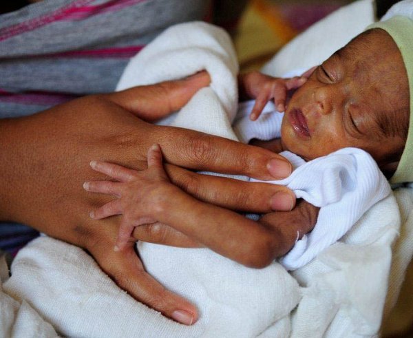 předčasně narozené dítě