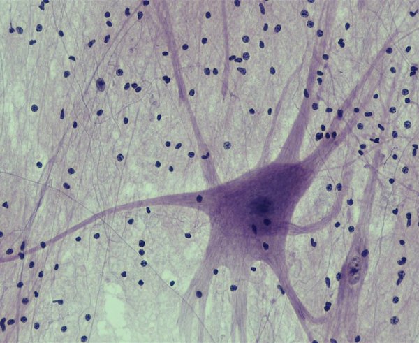 neuron