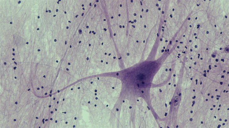 neuron