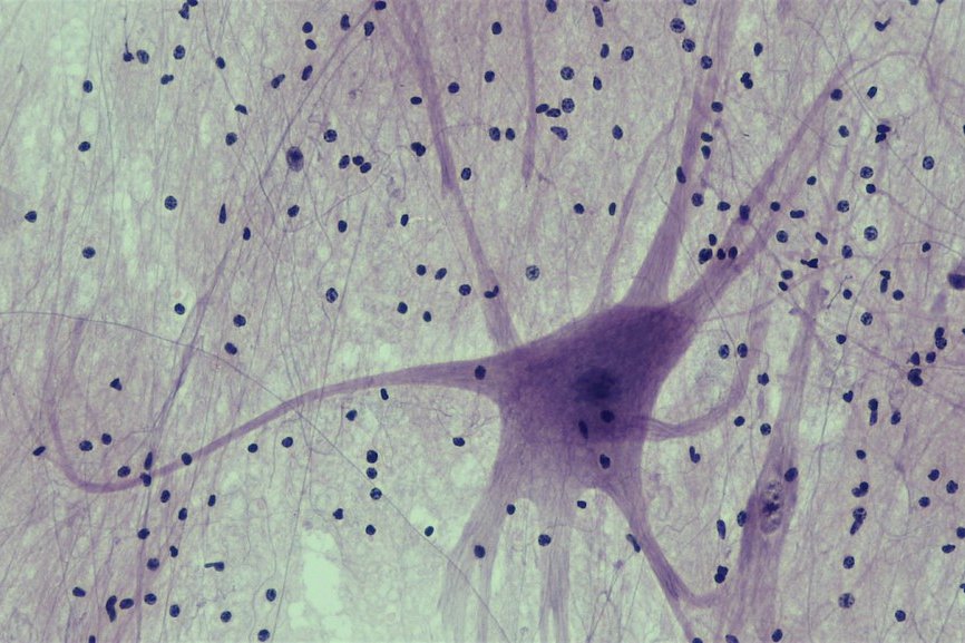 neuron