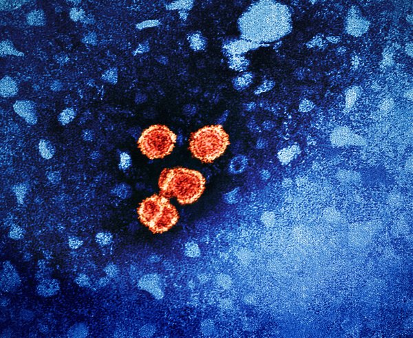 Virus žloutenky typu B.