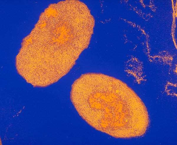 Bakterie Bordetella pertussis způsobující černý kašel.