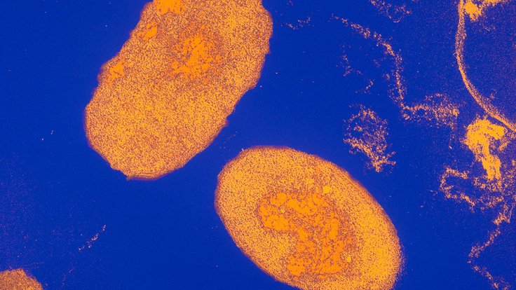 Bakterie Bordetella pertussis způsobující černý kašel.
