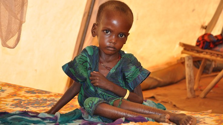 vyhublé dítě Etiopie hladomor