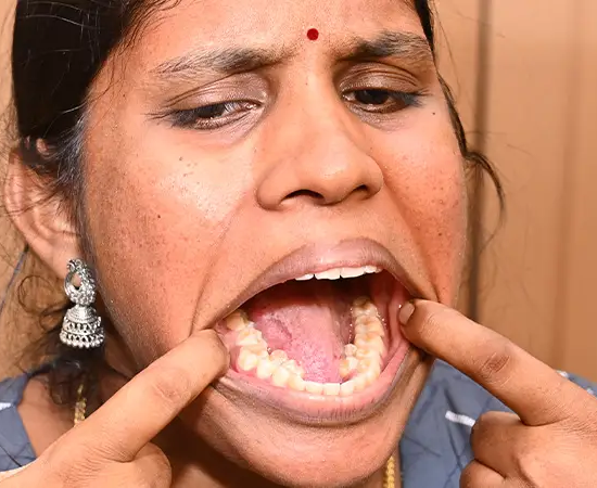 Indka Kalpana Balan má 38 zubů