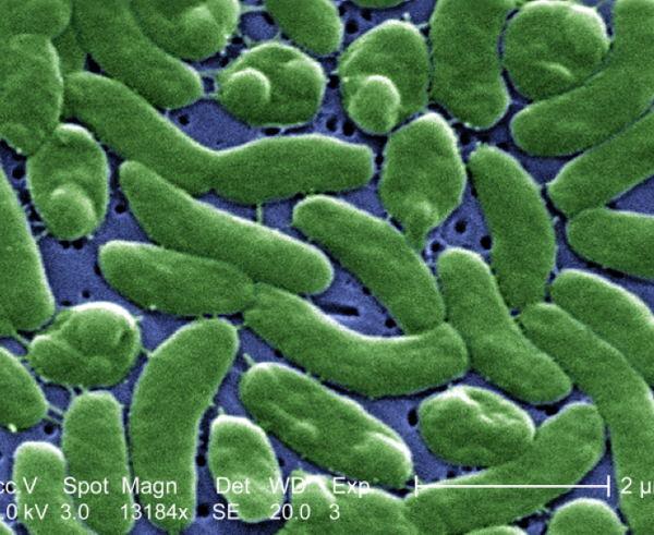 Vibrio_vulnificus_01