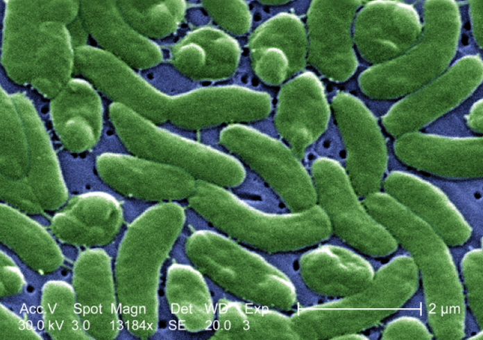 Vibrio_vulnificus_01