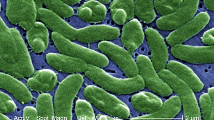 Vibrio_vulnificus_01