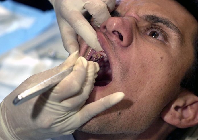 a-paraguayan-man-get-a-tooth-pulled-during-a-medical-exercise-at-cerro-membre-2afa27-1024