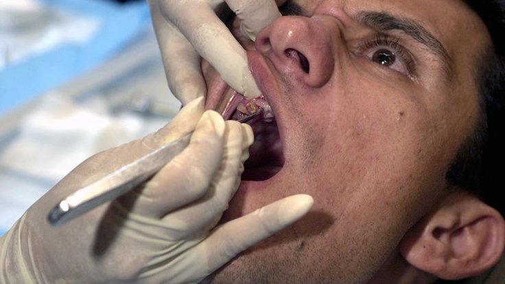 a-paraguayan-man-get-a-tooth-pulled-during-a-medical-exercise-at-cerro-membre-2afa27-1024