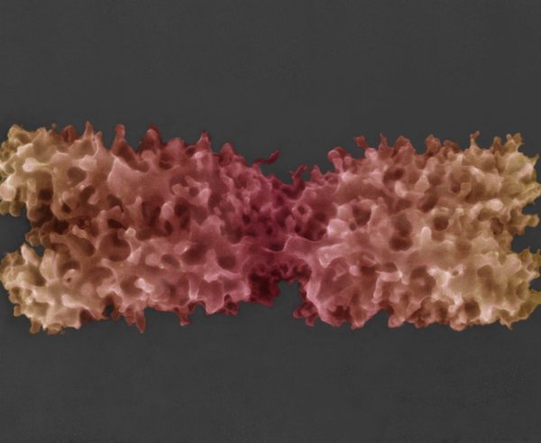 Kolorovaný snímek chromozomu v nativním stavu získané pomocí nově vyvinuté pokročilé environmentální rastrovací elektronová mikroskopie.