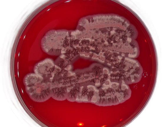 Houba Exobasidium v kultuře roste jako kvasinka produkující výrazně červené pigmenty – gunaciny.