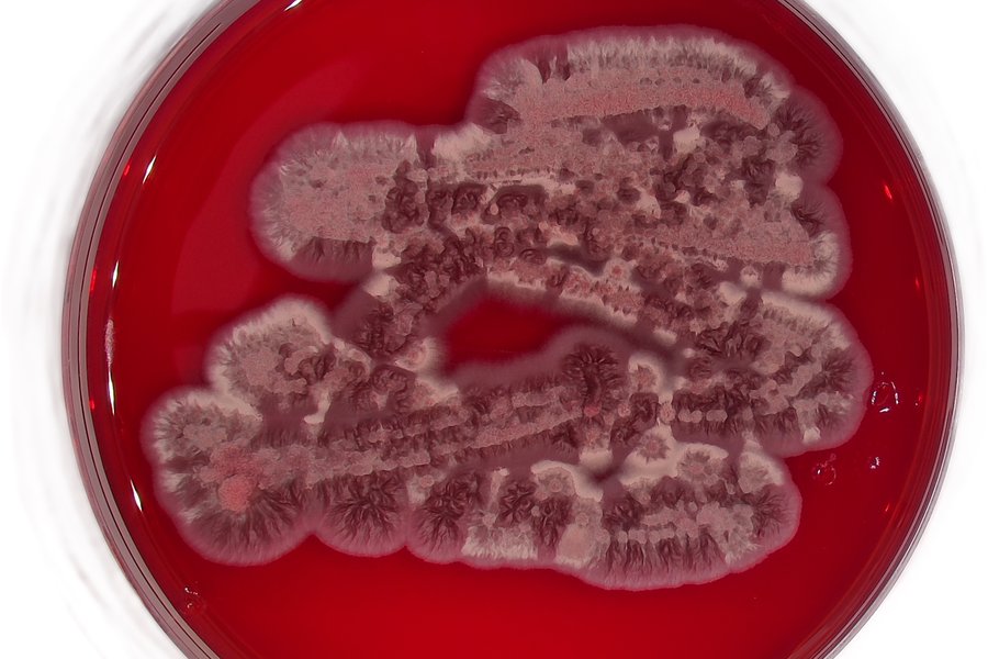 Houba Exobasidium v kultuře roste jako kvasinka produkující výrazně červené pigmenty – gunaciny.