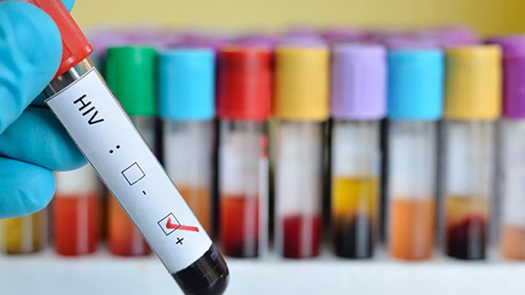 HIV
