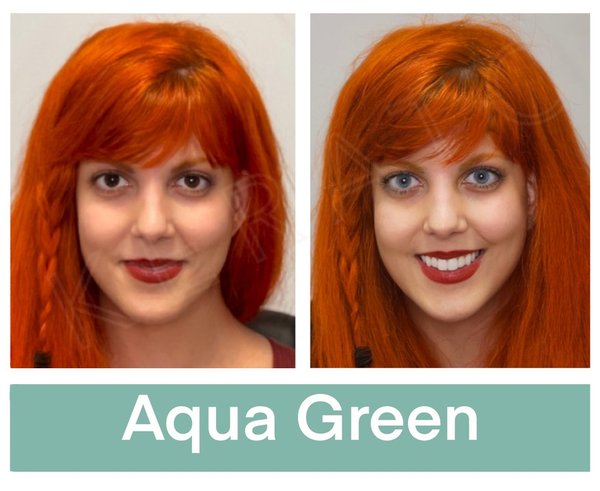 keratopigmentation+patient+eyes+with+aqua+green+pigment+before+and+after+the+kerato+procedure.jpg