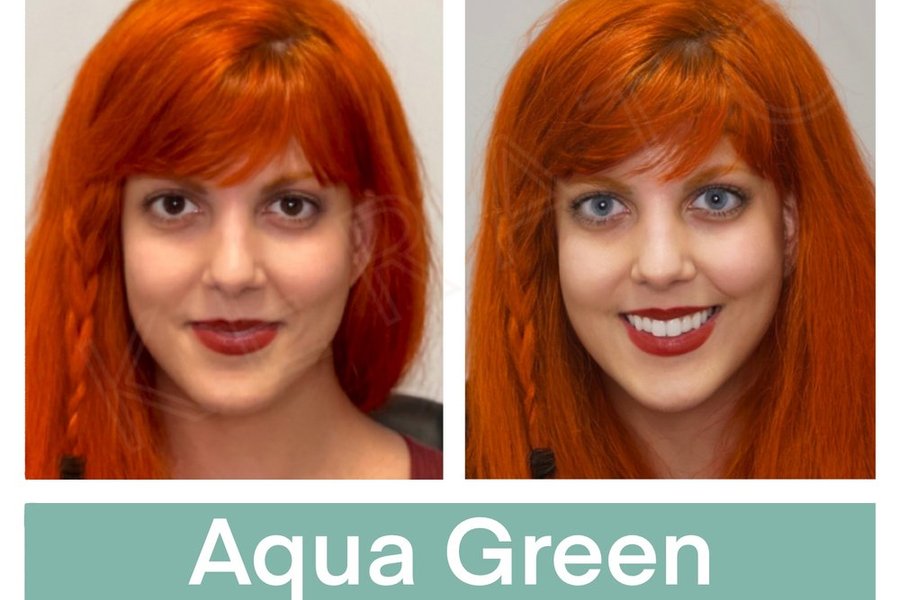 keratopigmentation+patient+eyes+with+aqua+green+pigment+before+and+after+the+kerato+procedure.jpg