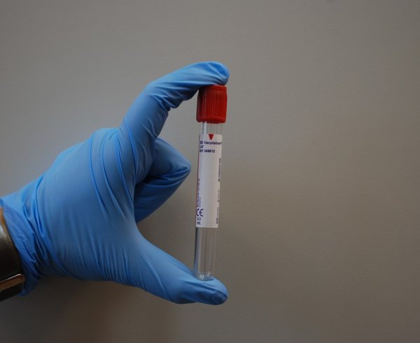 laboratory_medical_lab_diagnostics_blood_tube_glove_diagnostician-1341945