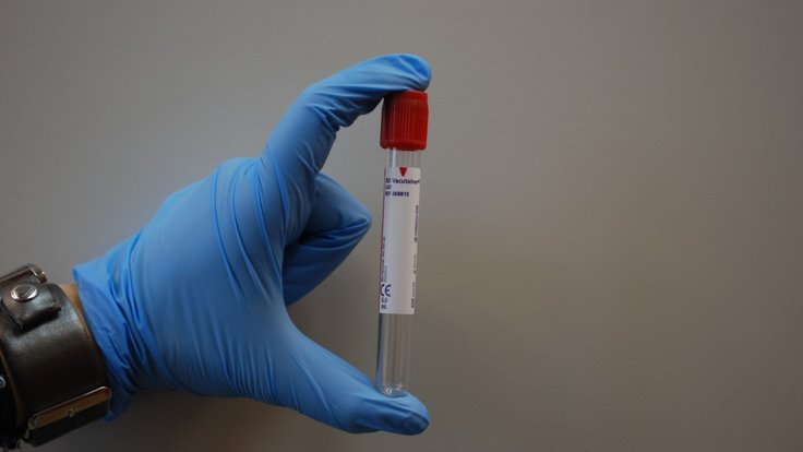 laboratory_medical_lab_diagnostics_blood_tube_glove_diagnostician-1341945