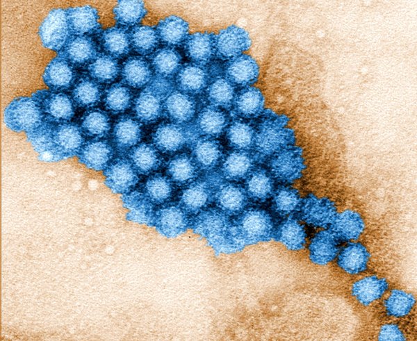 norovirus