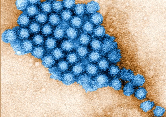 norovirus