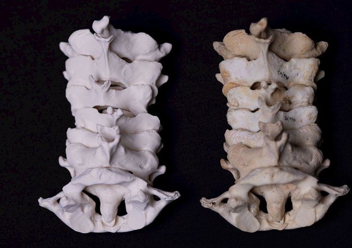 3D tisk anatomických modelů