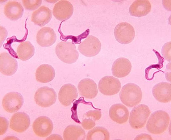 trypanosomiasis