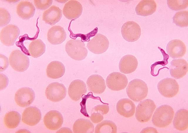 trypanosomiasis