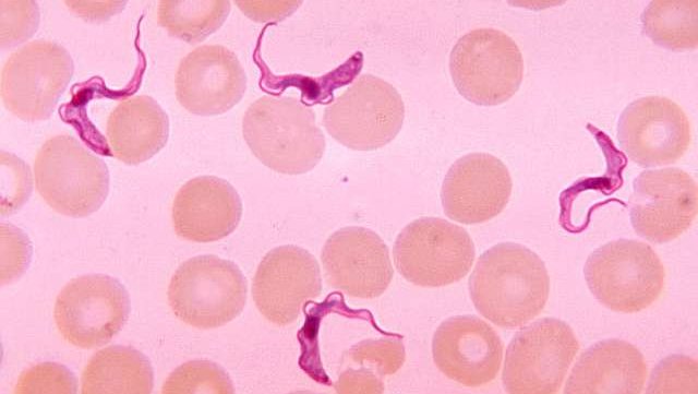 trypanosomiasis